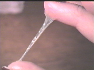 Выделения при беременности | Что можно во время Кровянистые выделения и кровотечения во время беременности