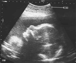 29 неделя беременности 29 неделя беременности