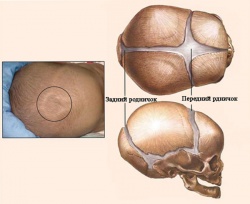 Родничок у новорожденных Родничок у новорожденных