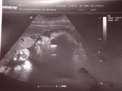 фото узи 34 неделе беременности 3333333333333.jpeg