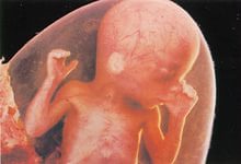 32 неделя беременности 32 неделя беременности