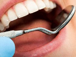 Кровоточивость десен во время беременности Кровоточивость десен во время беременности