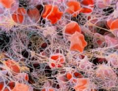 Генетика рождение больного ребенка Генетика рождение больного ребенка