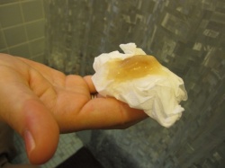 Что такое бели у девочек и женщин? Что такое бели у девочек и женщин?