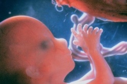 Маловодие при беременности Маловодие при беременности