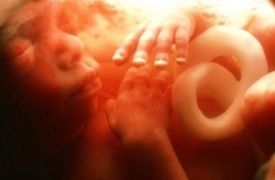 20 неделя беременности 20 неделя беременности