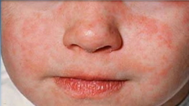 рсрапр.jpg рсрапр.jpg