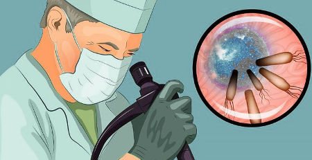 Что показывает ФГС желудка