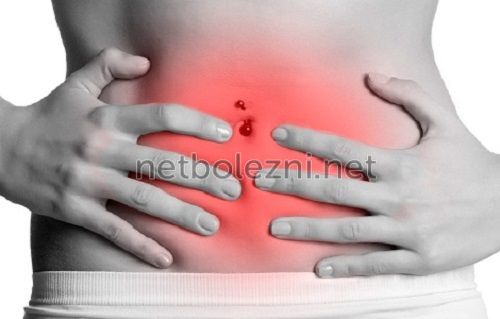 Что такое дисбактериоз кишечника