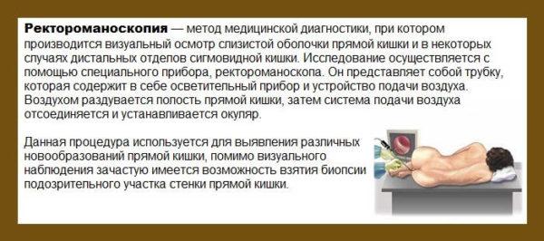 Что такое ректороманоскопия