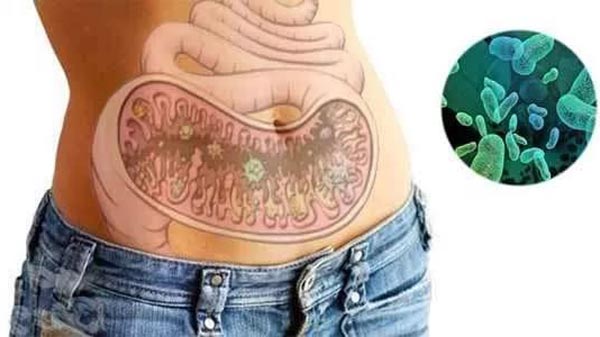 дисбактериоз