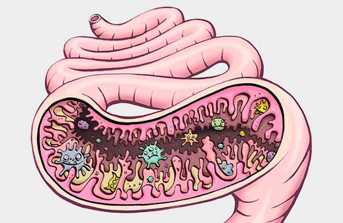 Дрожжевой грибок в кале у женщин