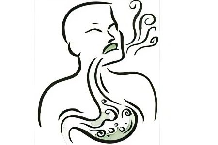 Изжога в горле: причины, симптомы и лечение