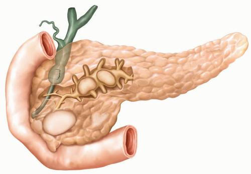 кал при панкреатите