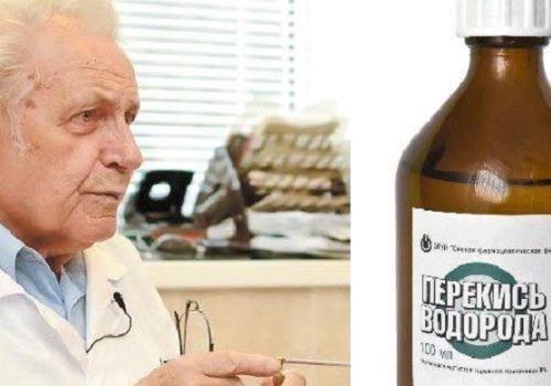 Лечение геморроя по Неумывакину: методы профессора при помощи соды и перекиси водорода