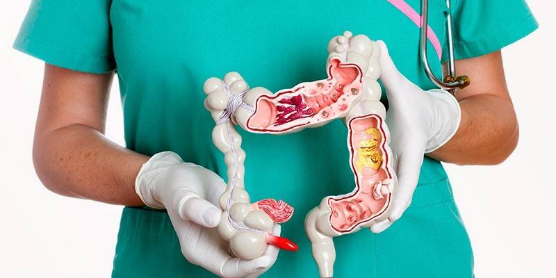 Макет кишечника человека