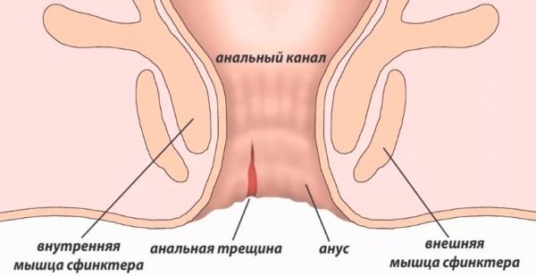 Мази при анальной трещине у ребенка, взрослых эффективные при ГВ, геморрое, беременности