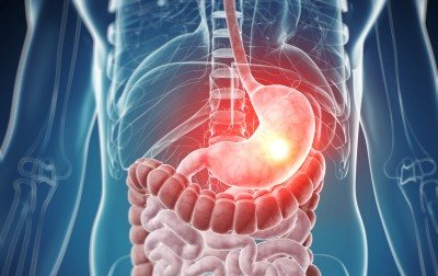 Неправильное питание, перекусы на бегу или обильная пища на ночь - все это может привести к тому, что желудок не переваривает пищу