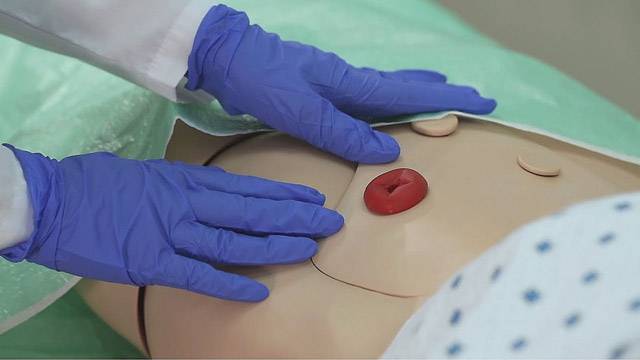 операция по удалению стомы прямой кишки