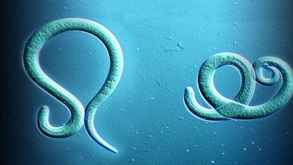 Острицы под микроскопом