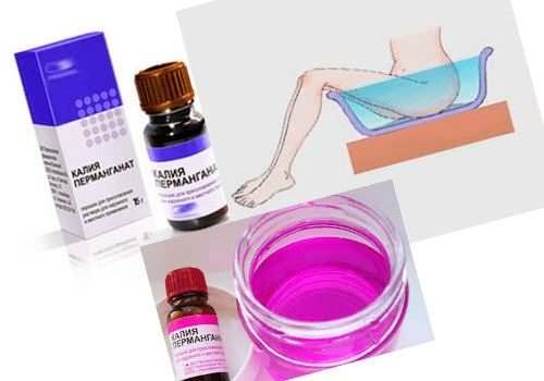 Сидячие ванночки с марганцовкой