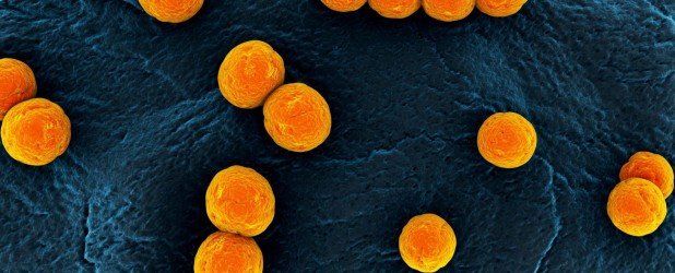 стафилококк золотистый