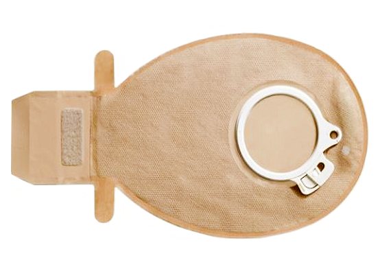 Стома после операций на кишечнике