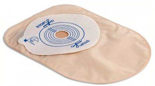 Стома после операций на кишечнике