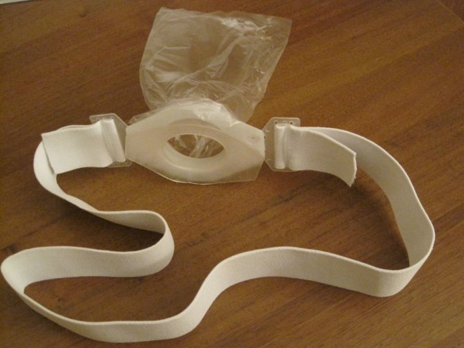 Стома после операций на кишечнике