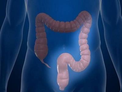 Свечи при воспалении прямой кишки лечение