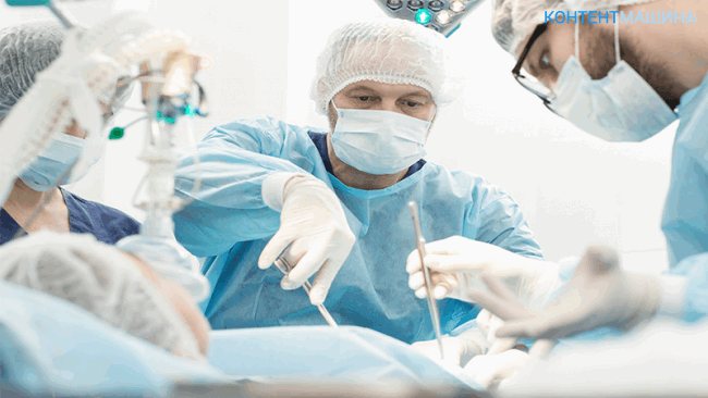 unnamed file 22 - Операция на поджелудочной железе: виды, показания, послеоперационный период