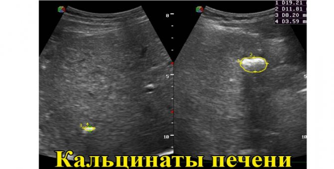 УЗИ органов брюшной полости