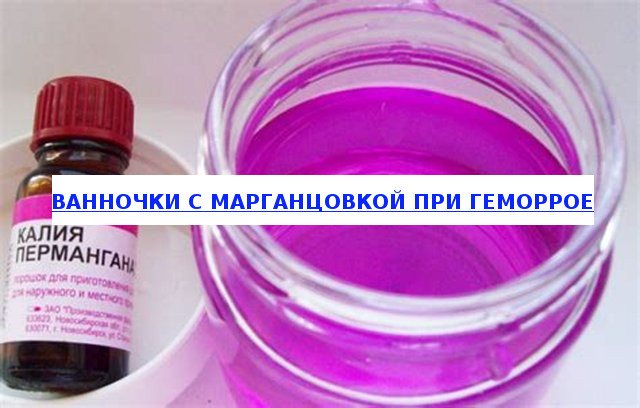 Ванночки с марганцовкой при геморрое
