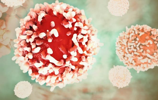 Злокачественная опухоль под микроскопом